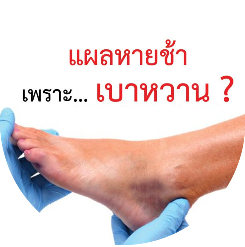 เบาหวาน ภัยร้ายที่มาอย่างเงียบๆ