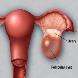 CYST1