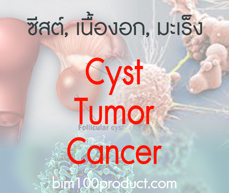 CYST