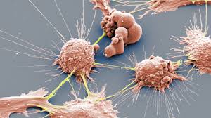 Tumor