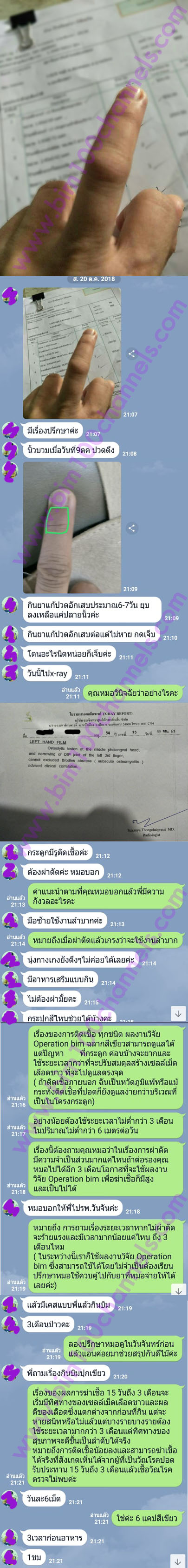 รีวิวถามตอบในไลน์กับปัญหาสุขภาพ